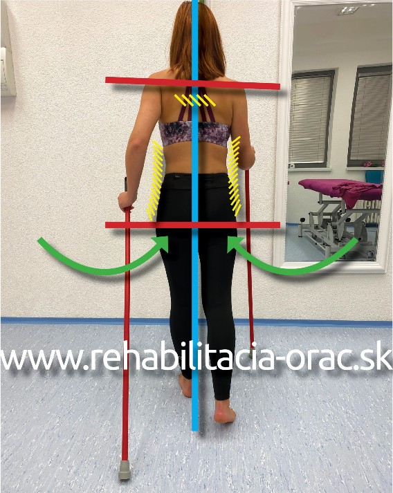 Nordic walking rehabilitacia orac